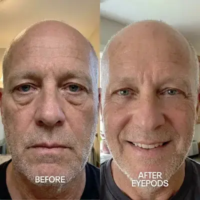 Before and After 4