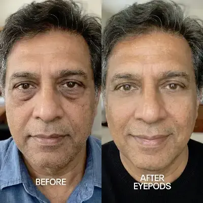 Before and After 3