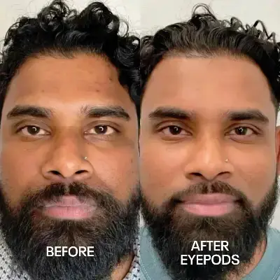 Before and After 4