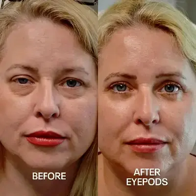 Before and After 3