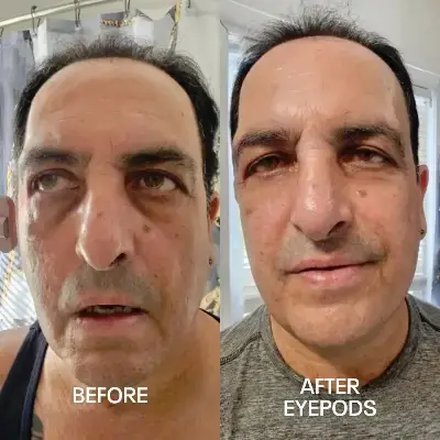 Before and After 2