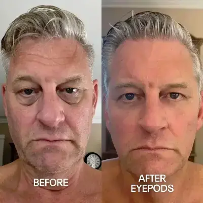 Before and After 3