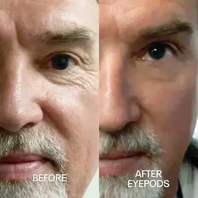 Before and After 6
