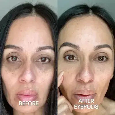 Before and After 2