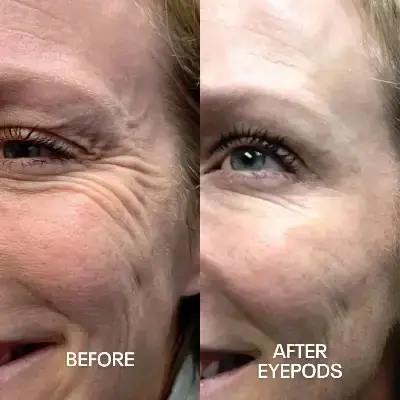 Before and After 5
