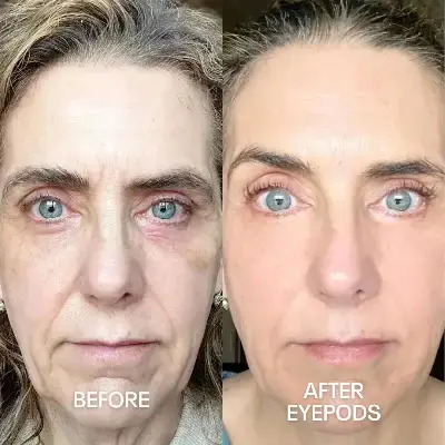 Before and After 1