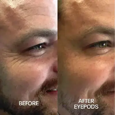 Before and After 4