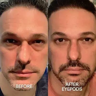 Before and After 5