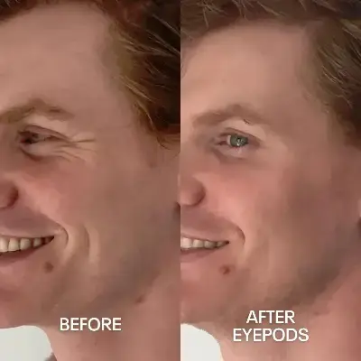 Before and After 5