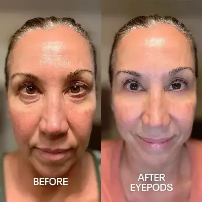 Before and After 2