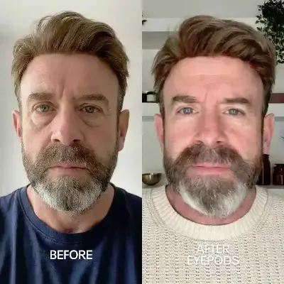 Before and After 1