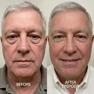 Before and After 5