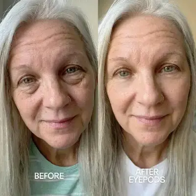 Before and After 1