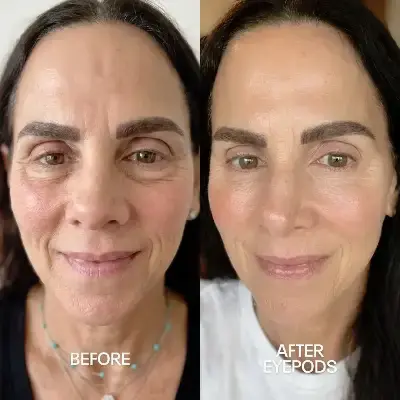 Before and After 1