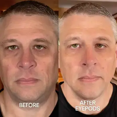 Before and After 1