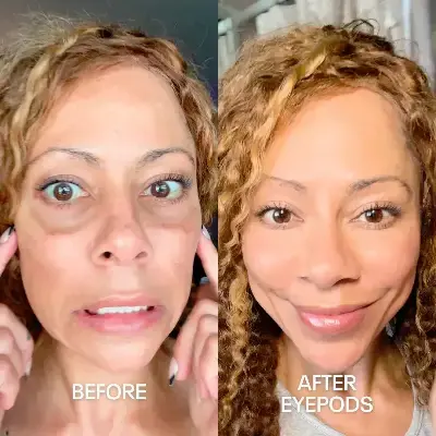 Before and After 1