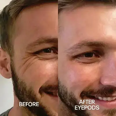 Before and After 3