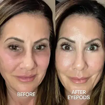 Before and After 4