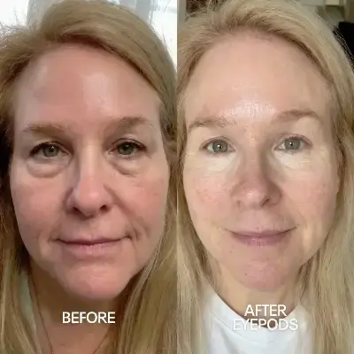 Before and After 1