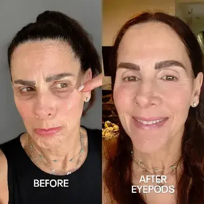 Before and After 3