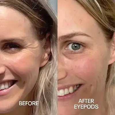 Before and After 4